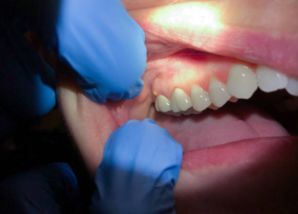 Best Urgent Tooth Repair  in Nevada, IA